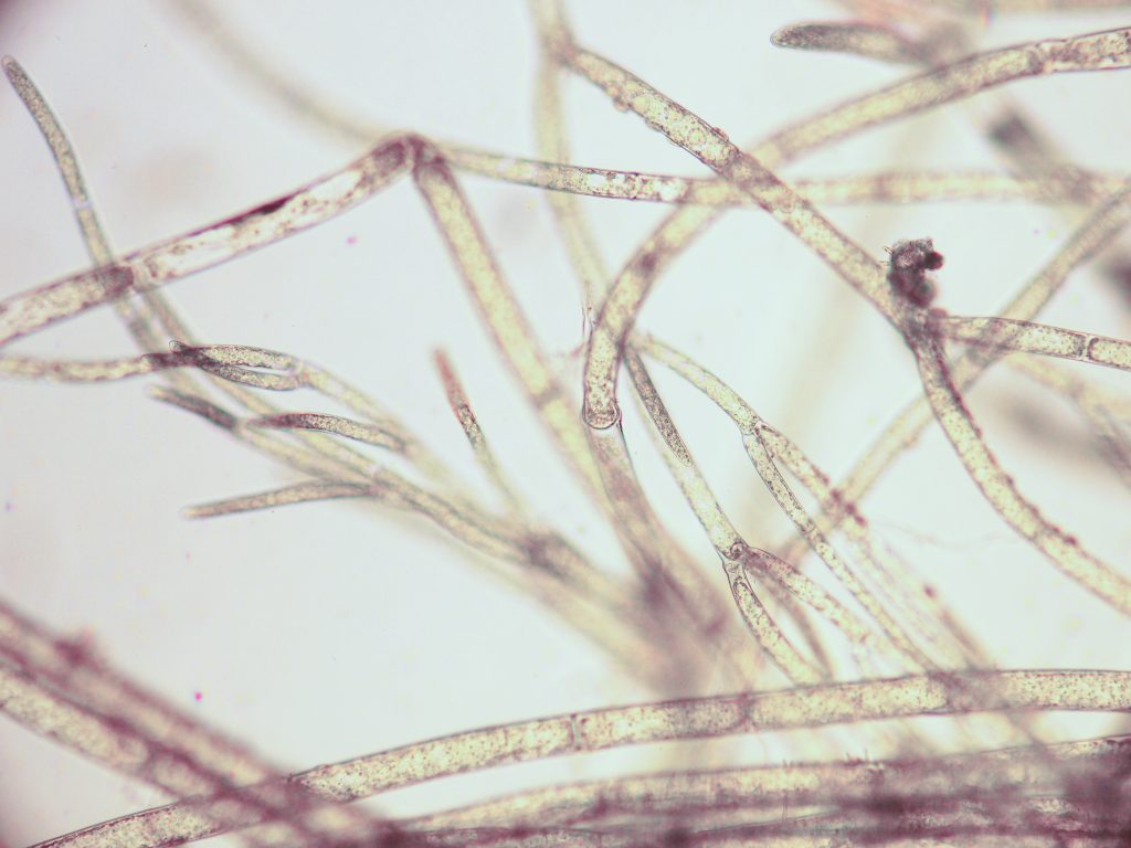 Cladophora Algae.  [Eric Peterson, TRRP/Reclamation]